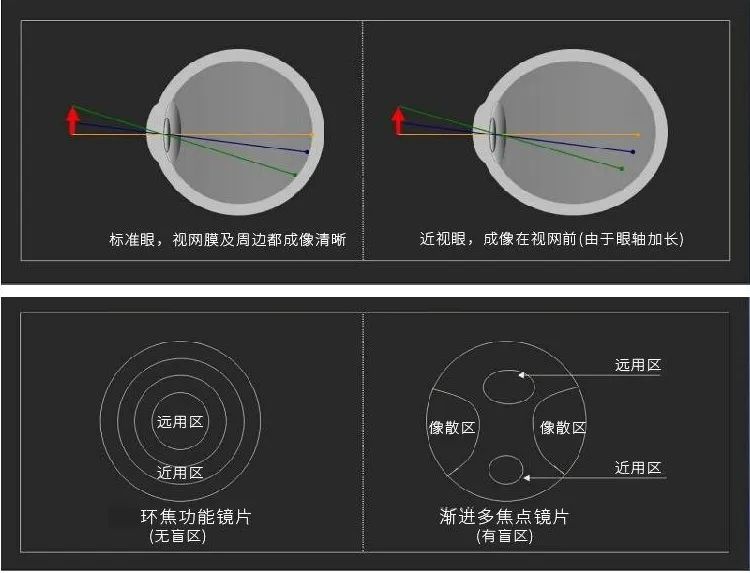 环焦镜片的原理和作用